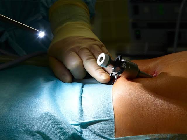 Is Open Spine Surgery Safe?