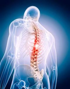 spine surgery
